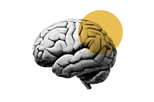 Neurofeedback