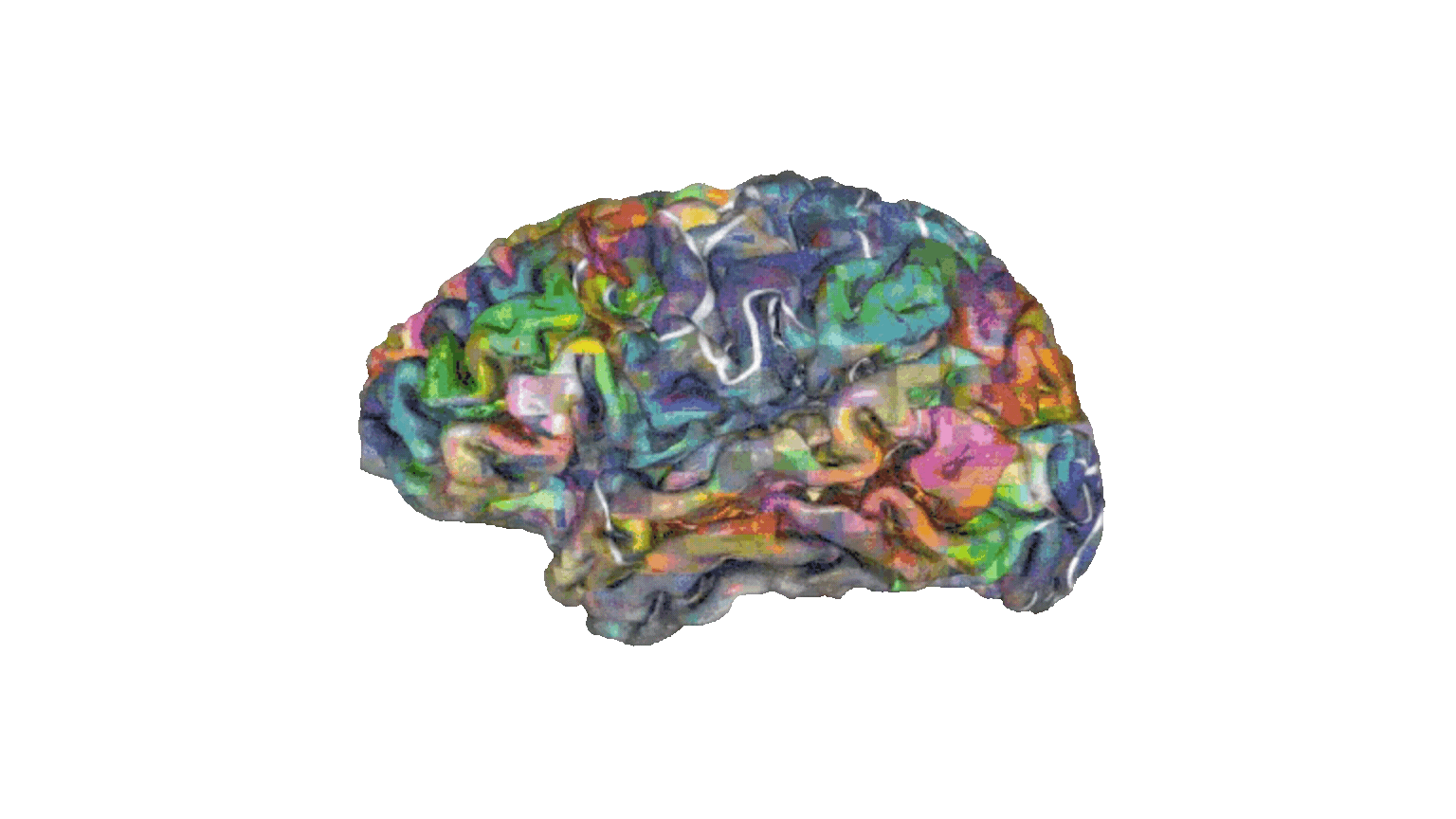 Animirani prikaz brain mapping (qEEG) postupka